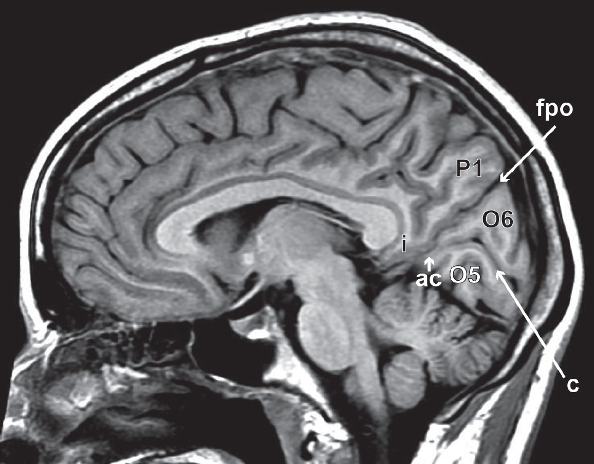 Anatomie du cortex cérébral : lobe occipital - Figure 3