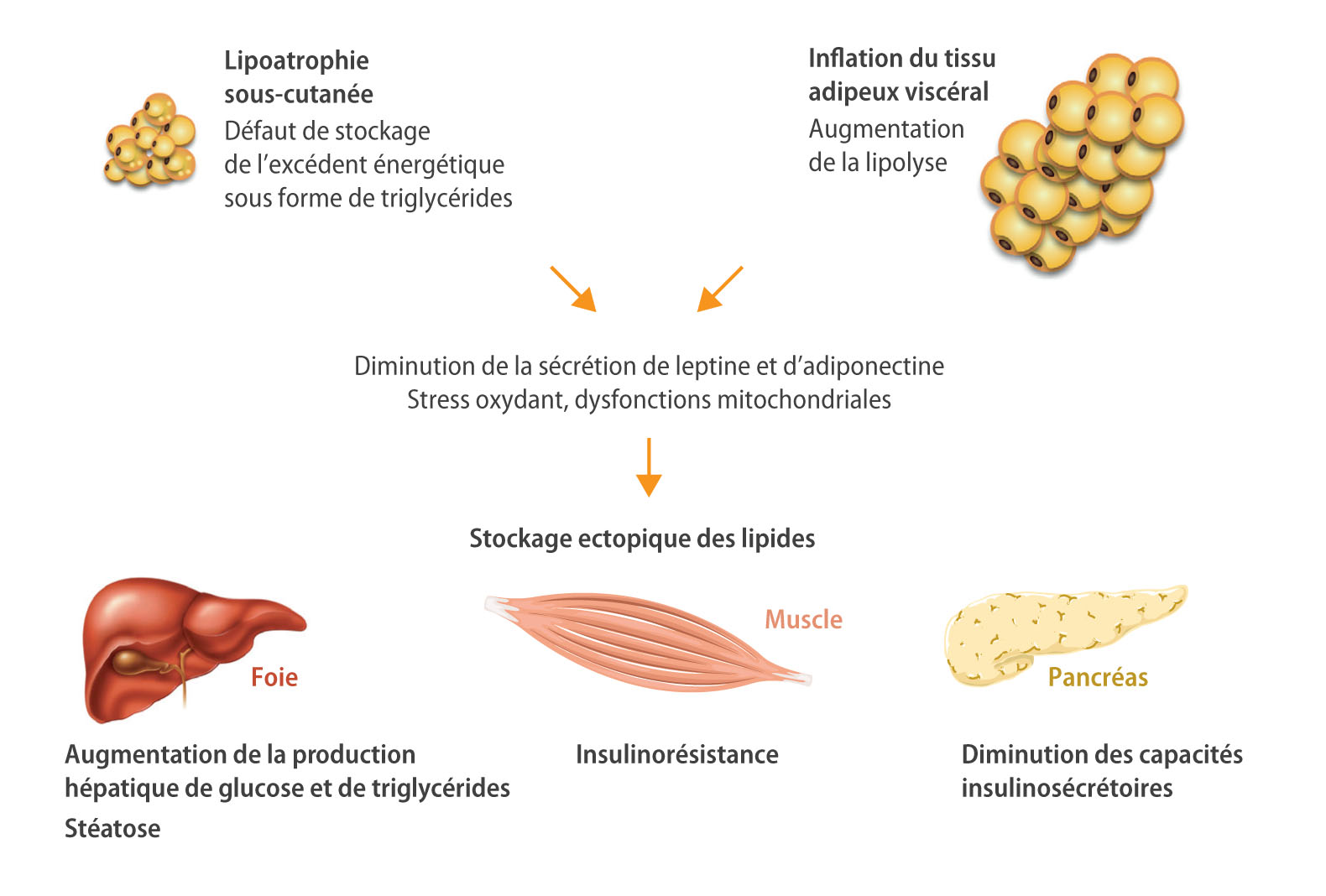 Syndromes de lipodystrophie et d'insulinorésistance - Figure 3