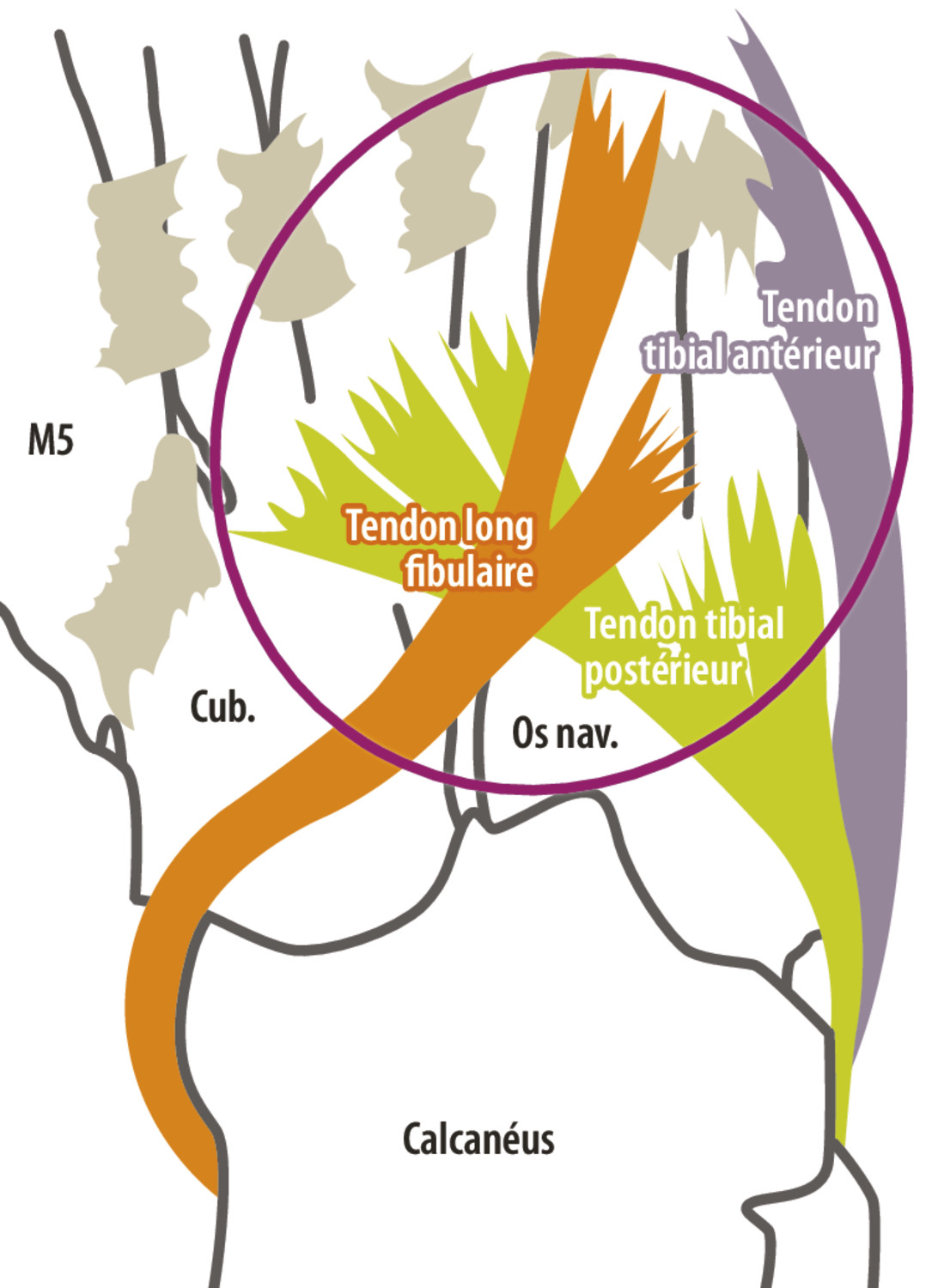 Les pathologies du tendon tibial postérieur - Figure 1