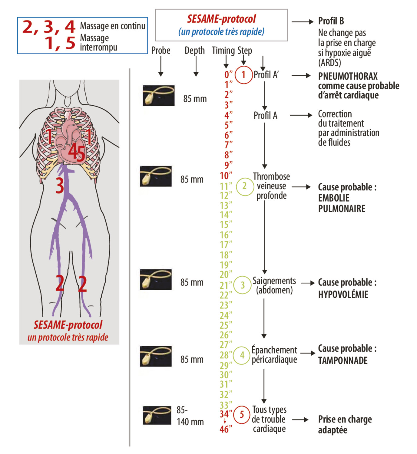 L’échographie pulmonaire, une discipline holistique Comment le BLUE-protocol peut-il impacter la cardiologie ? - Figure 7
