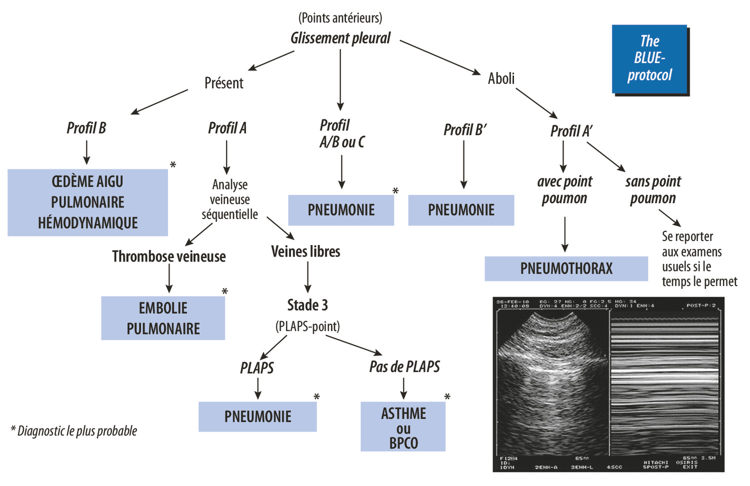 L’échographie pulmonaire, une discipline holistique Comment le BLUE-protocol peut-il impacter la cardiologie ? - Figure 5