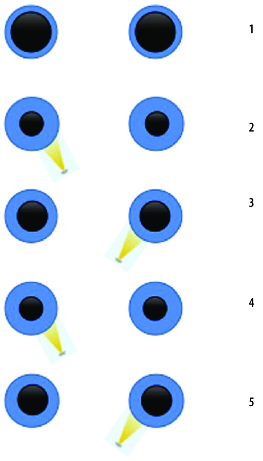 Orientation diagnostique d’une névrite optique - Figure 1