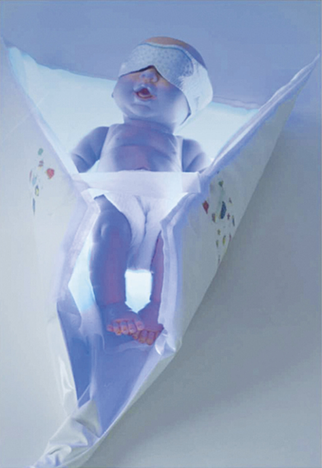 Nouveaux dispositifs de photothérapie néonatale - Figure 6