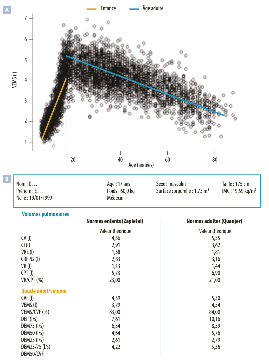 Équations GLI-2012 : genèse et mode d’emploi pour l’interprétation de la spirométrie - Figure 1