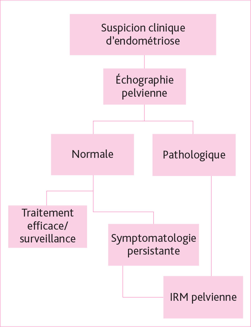 Dysménorrhées de l’adolescente : quand et comment diagnostiquer ­l’endométriose ? - Figure 6