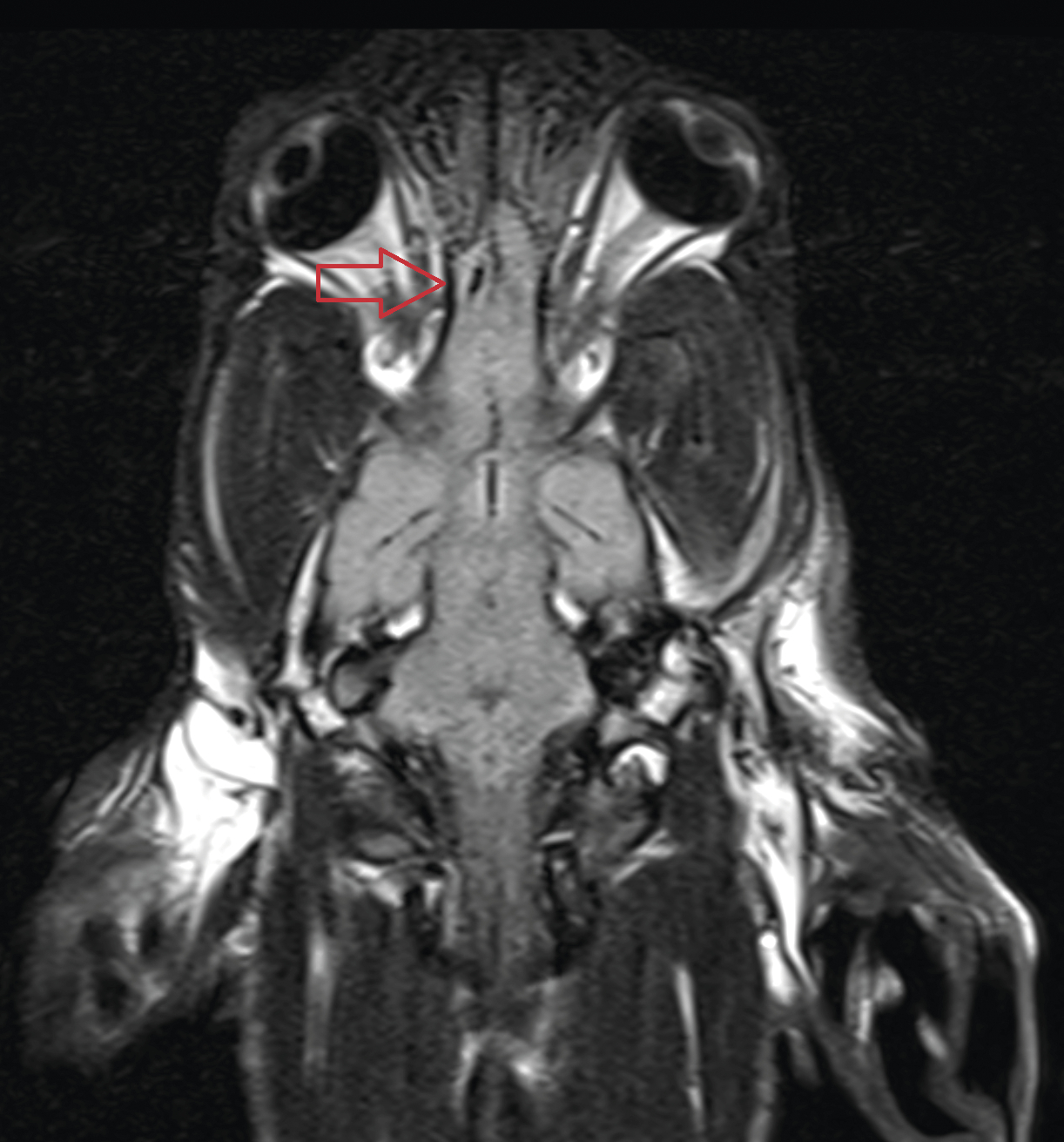 Traumatisme crânien chez un chiot présentant un ­hématome mésencéphalique - Figure 6