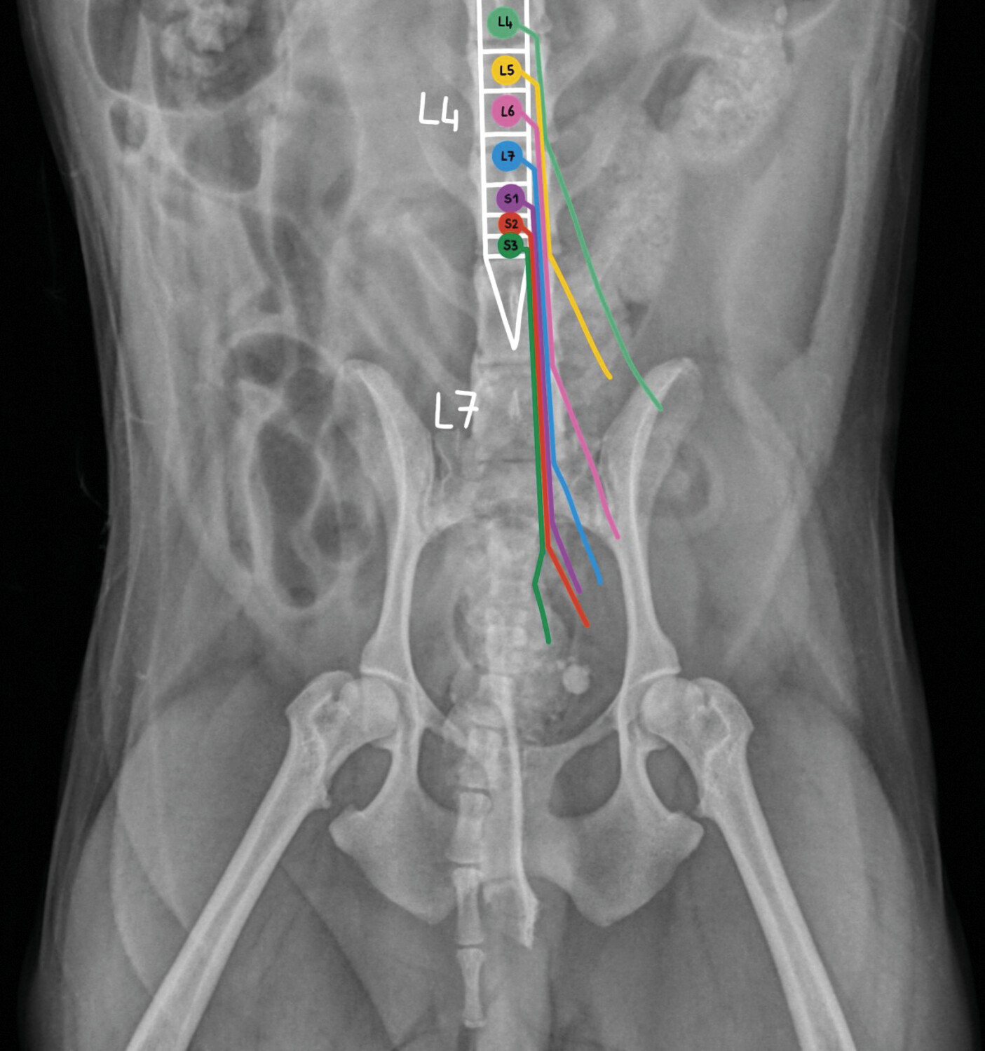 Diagnostic et traitement d’une tumeur ­extra­médullaire chez un chien - Figure 9