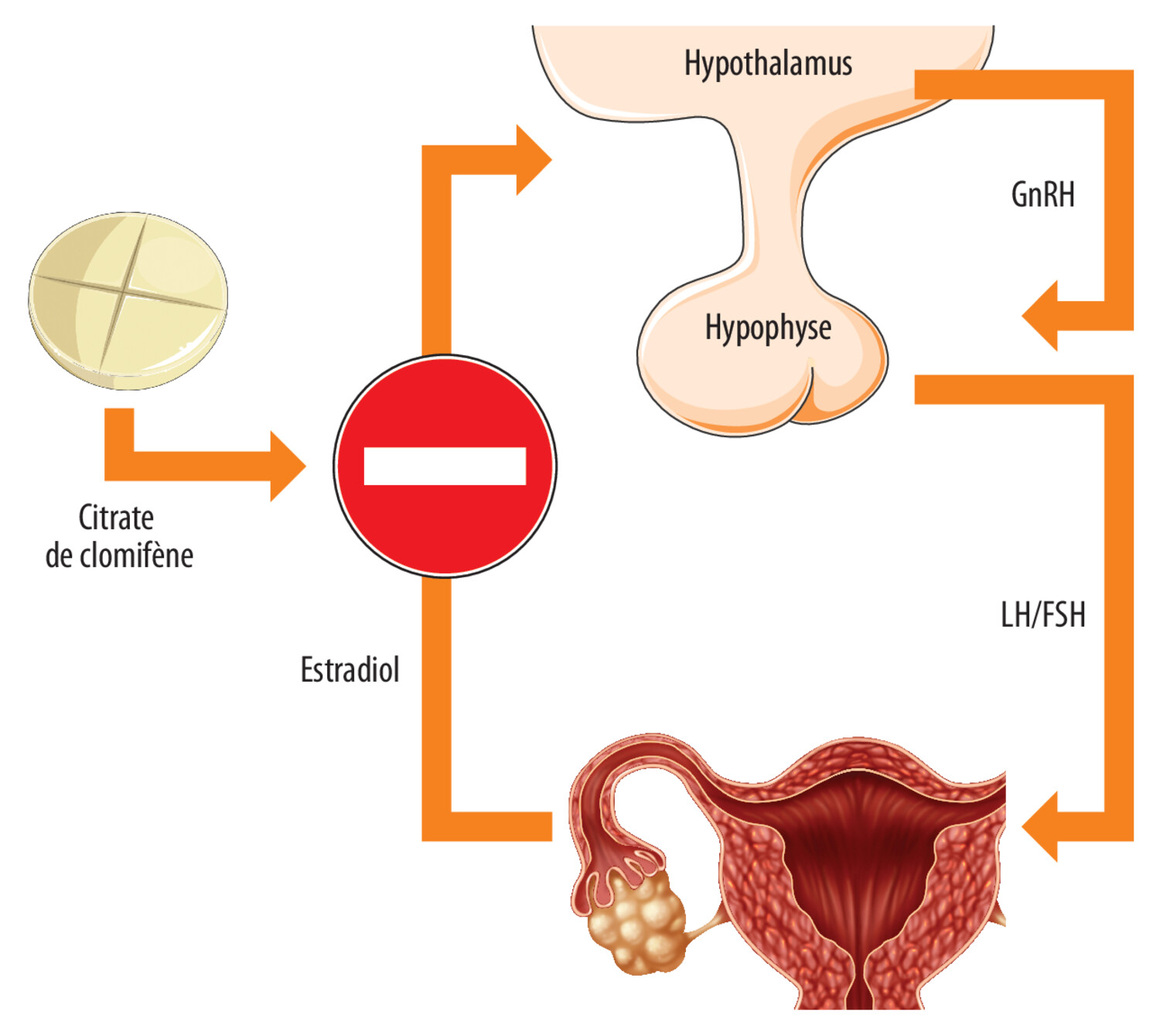 Prise en charge de l’infertilité dans le SOPK - Figure 2
