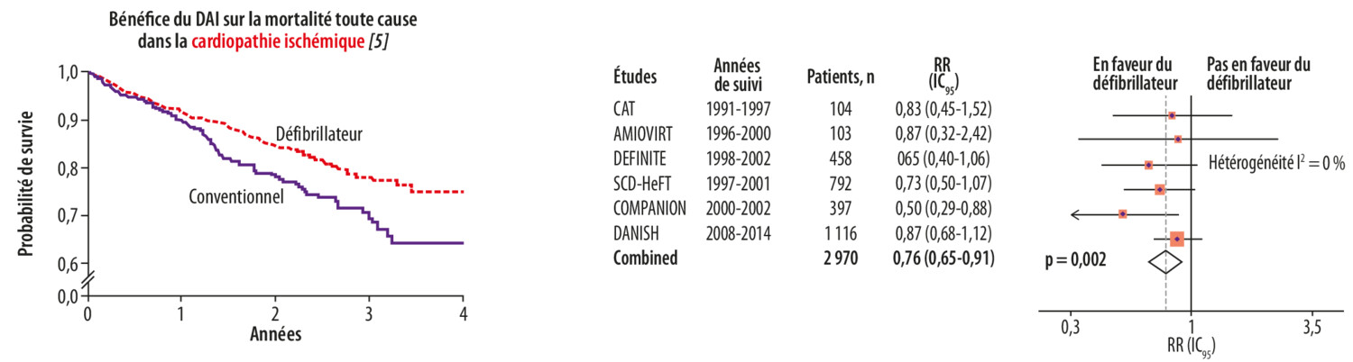 Défibrillateurs, resynchronisateurs : pour qui ? - Figure 1