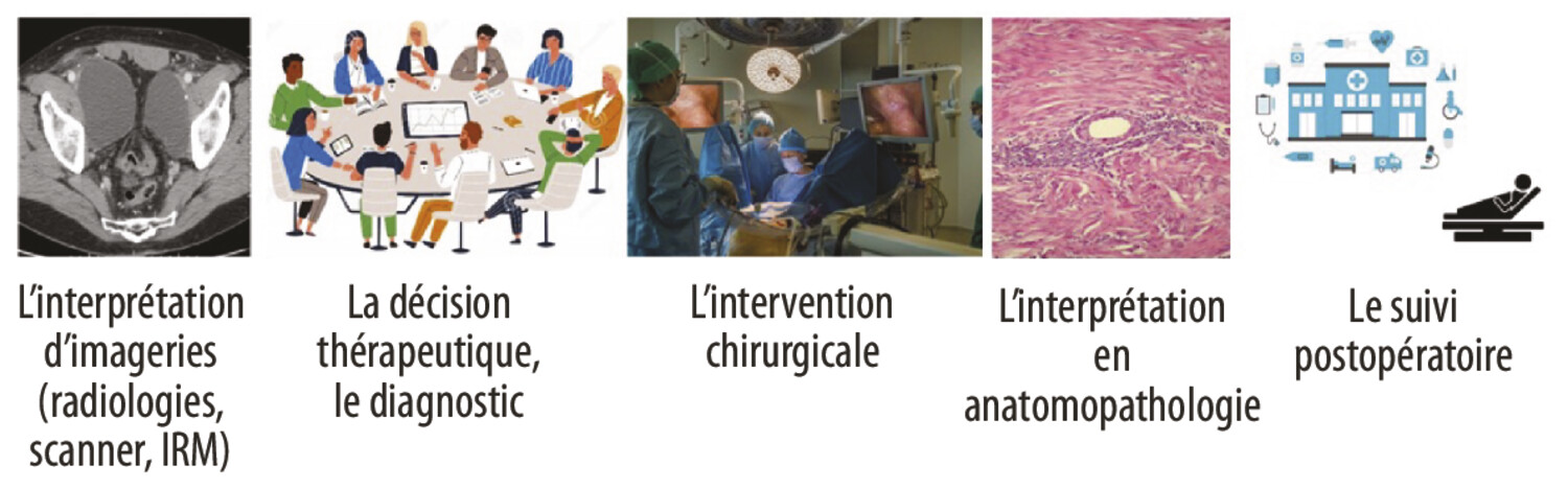 Intelligence artificielle et chirurgie mini-invasive - Figure 1