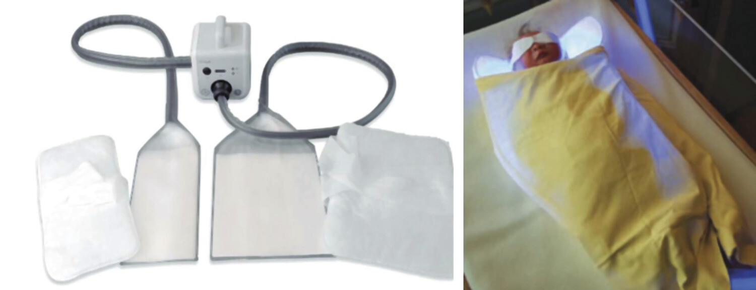 Nouveaux dispositifs de photothérapie néonatale - Figure 4