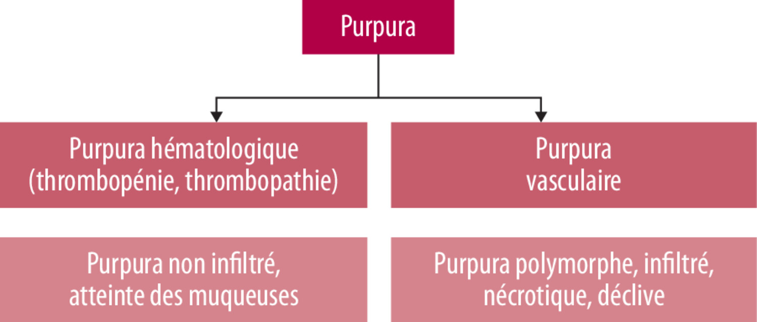 Association purpura-arthrites : conduite à tenir - Figure 1