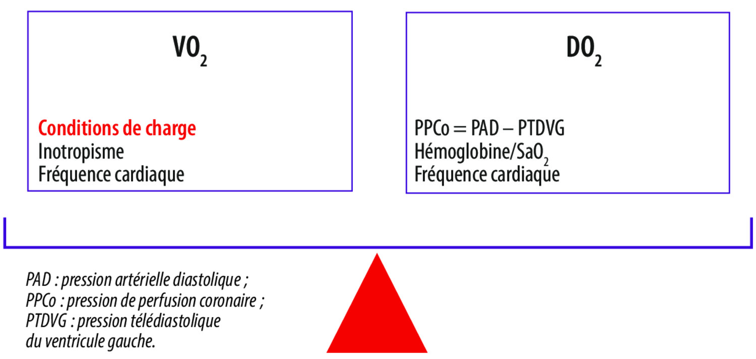 Gestion du remplissage en peropératoire chez le patient insuffisant cardiaque - Figure 3
