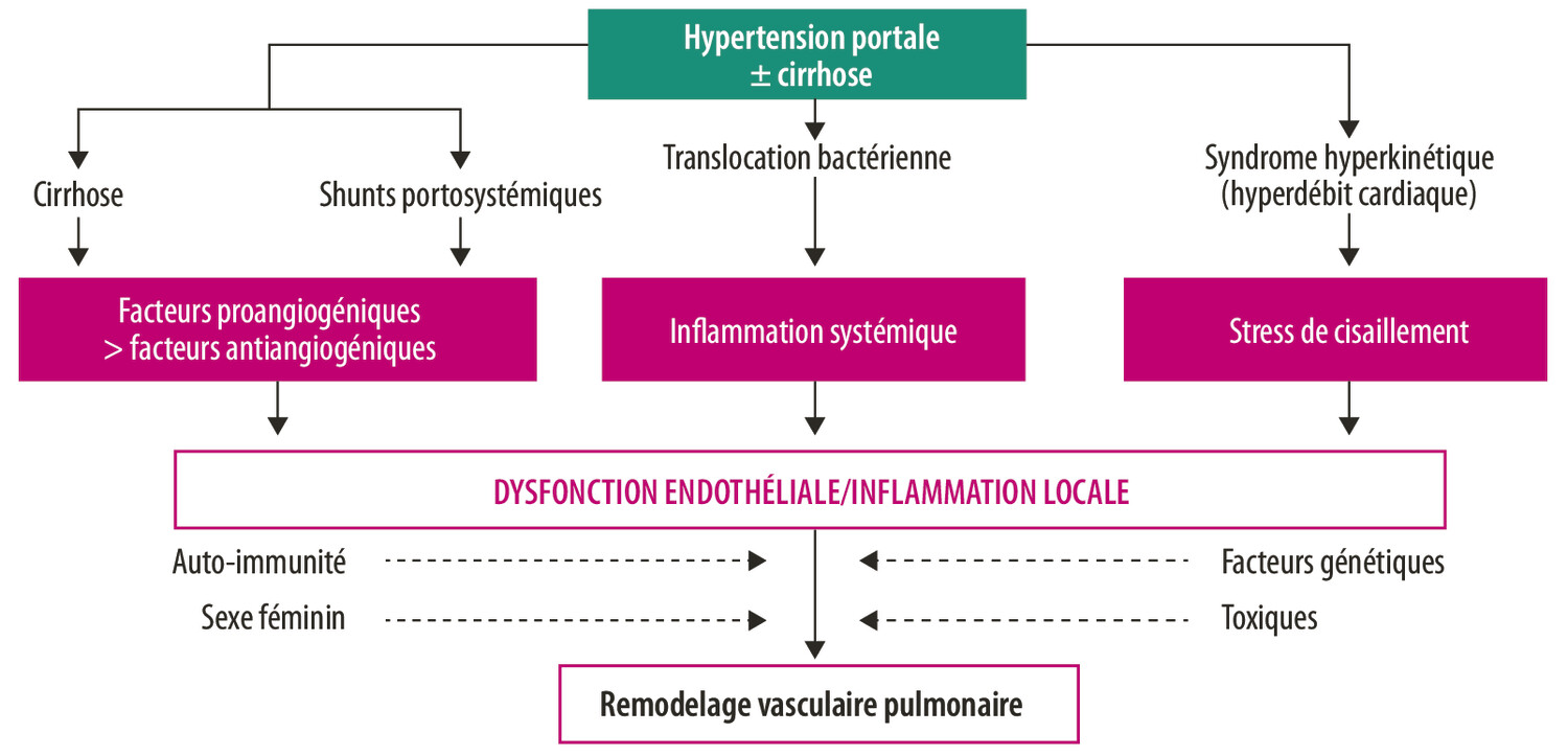 Hypertension portopulmonaire - Figure 1