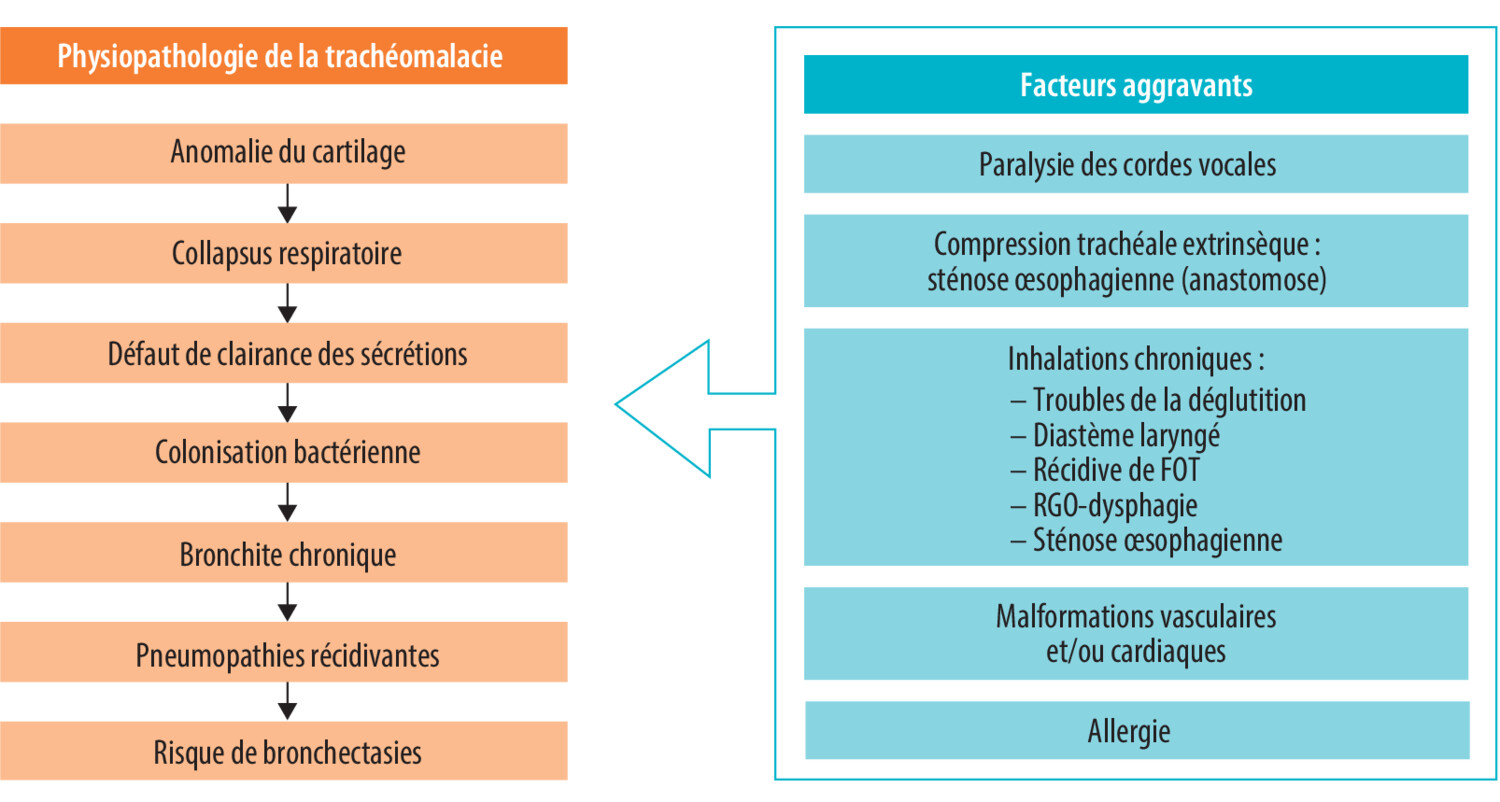La transition enfant-adulte des atrésies de l’œsophage : une maladie peu connue des pneumologues  - Figure 1