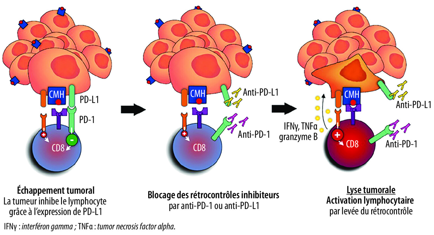 Gestion de la toxicité des immunothérapies : le modèle de la RCP iTox  - Figure 1
