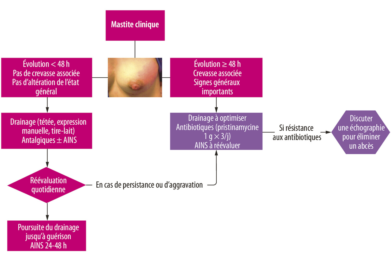 Diagnostic et prise en charge des complications inflammatoires ou infectieuses de l’allaitement maternel - Figure 1